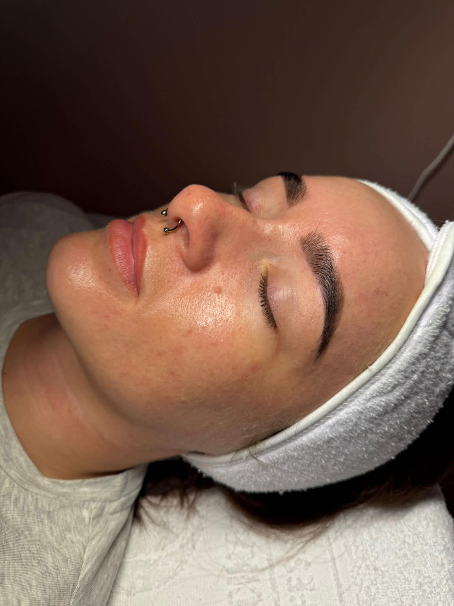 Client skin after facial treatment