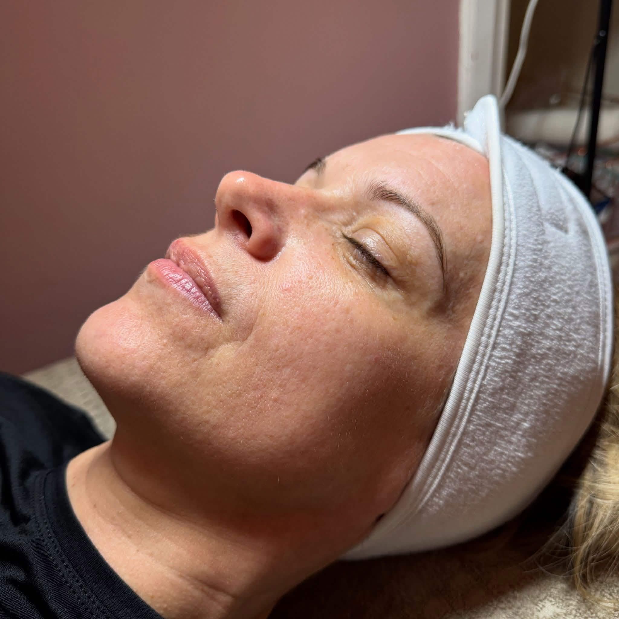 Client after facial treatment