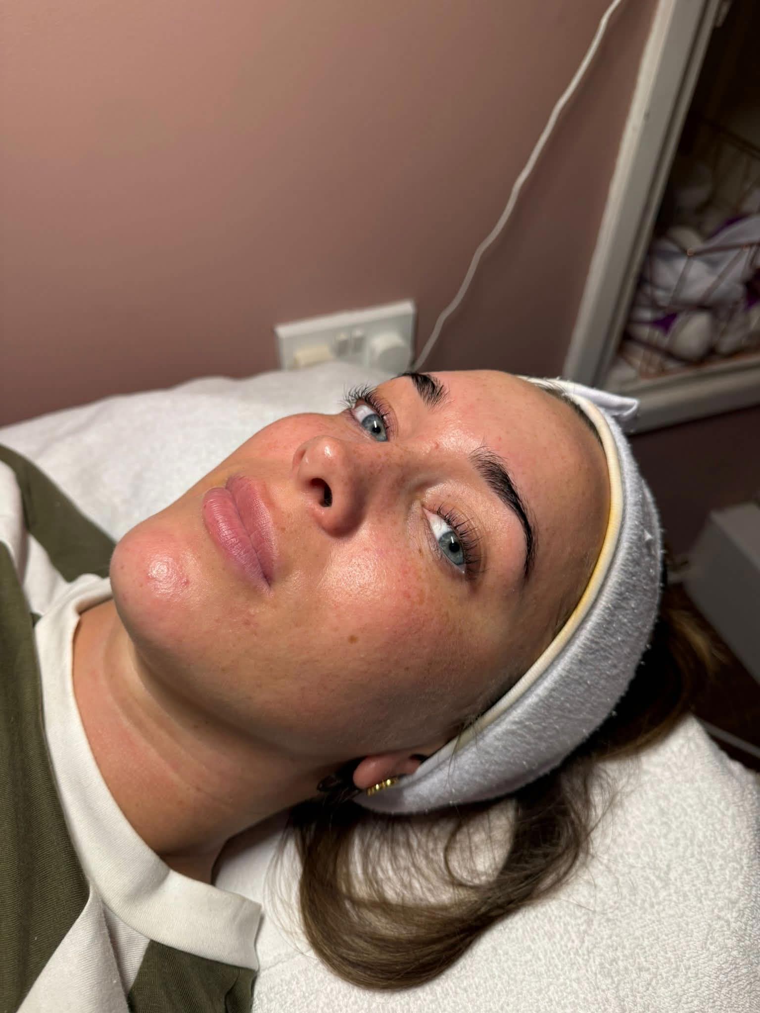 Client after facial treatment