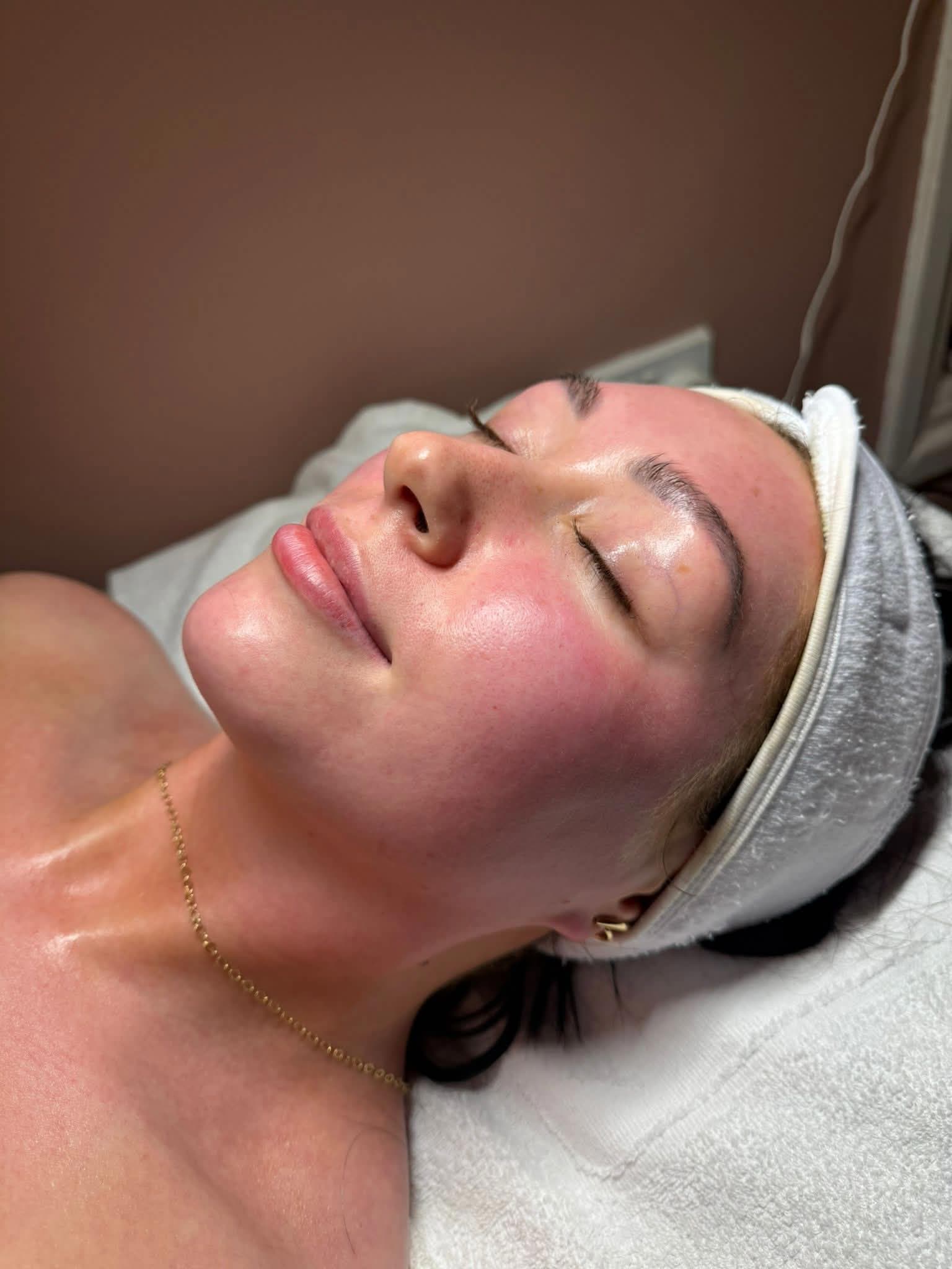Client skin after facial treatment with visible glow